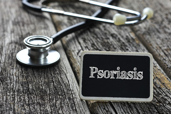 Psoriasis